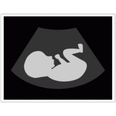 sonogram
